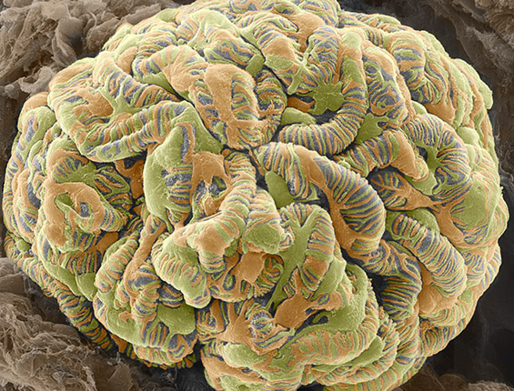 Kidney
