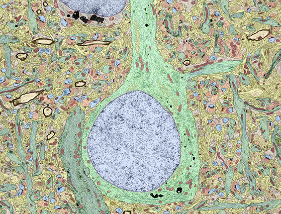 Neuron