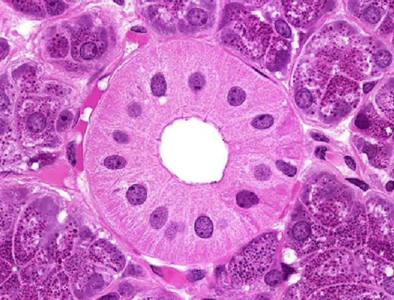Parotid