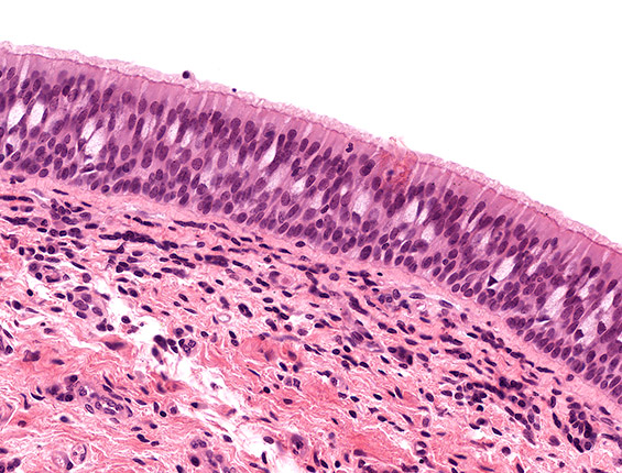 Larynx