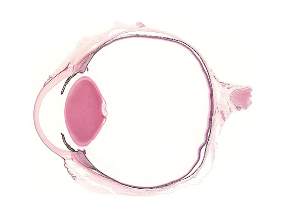 Eye