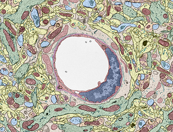 Brain